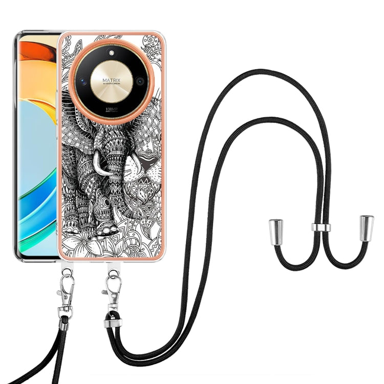 For Honor X9b Electroplating Dual-side IMD Phone Case with Lanyard