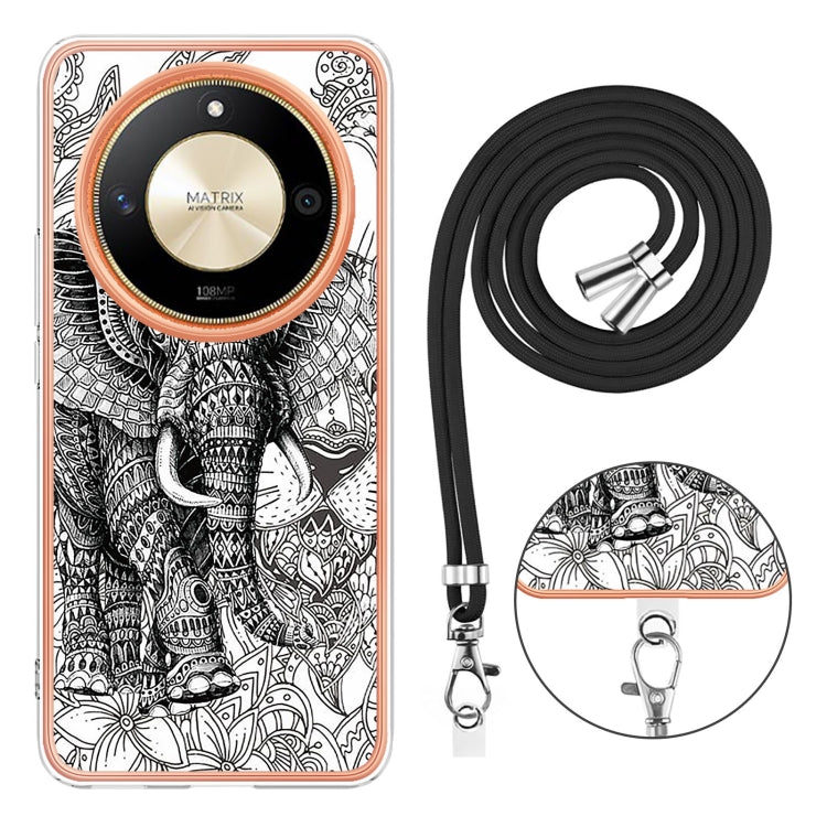 For Honor X9b Electroplating Dual-side IMD Phone Case with Lanyard