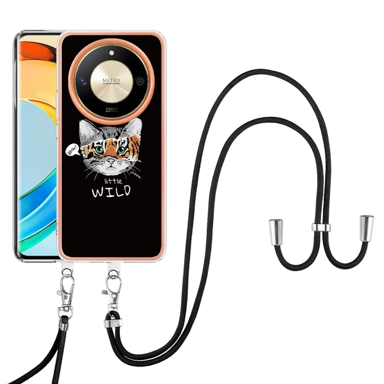 For Honor X9b Electroplating Dual-side IMD Phone Case with Lanyard