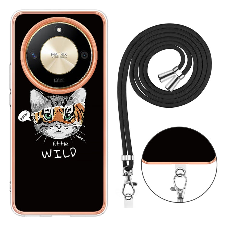 For Honor X9b Electroplating Dual-side IMD Phone Case with Lanyard