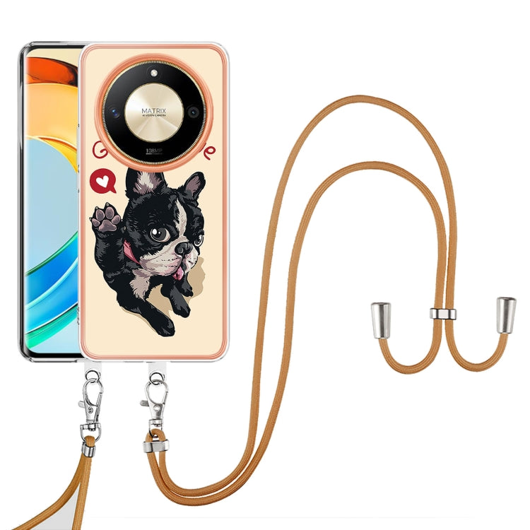 For Honor X9b Electroplating Dual-side IMD Phone Case with Lanyard