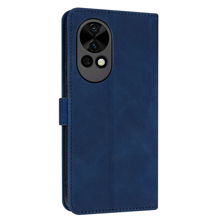 For Huawei nova 12 Pro AZNS Skin Feel Calf Texture Flip Leather Phone Case