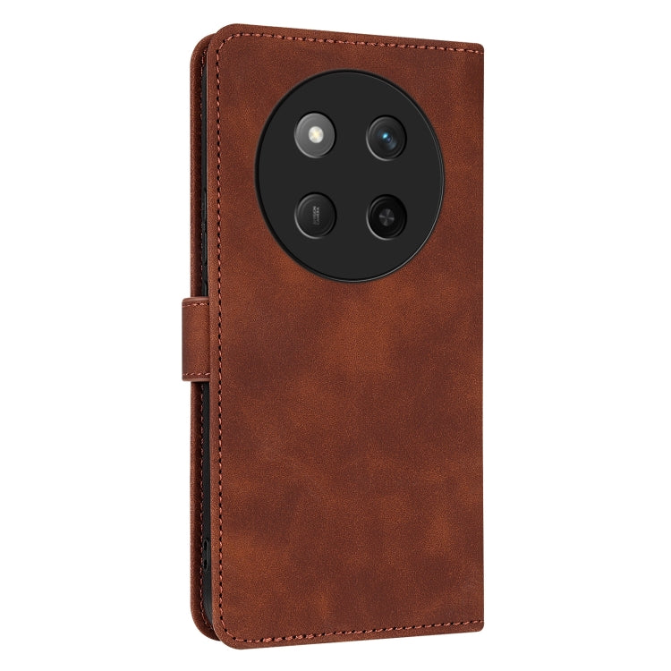 For Honor X60 Pro AZNS Skin Feel Calf Texture Flip Leather Phone Case