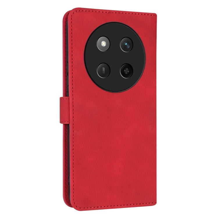 For Honor X60 Pro AZNS Skin Feel Calf Texture Flip Leather Phone Case