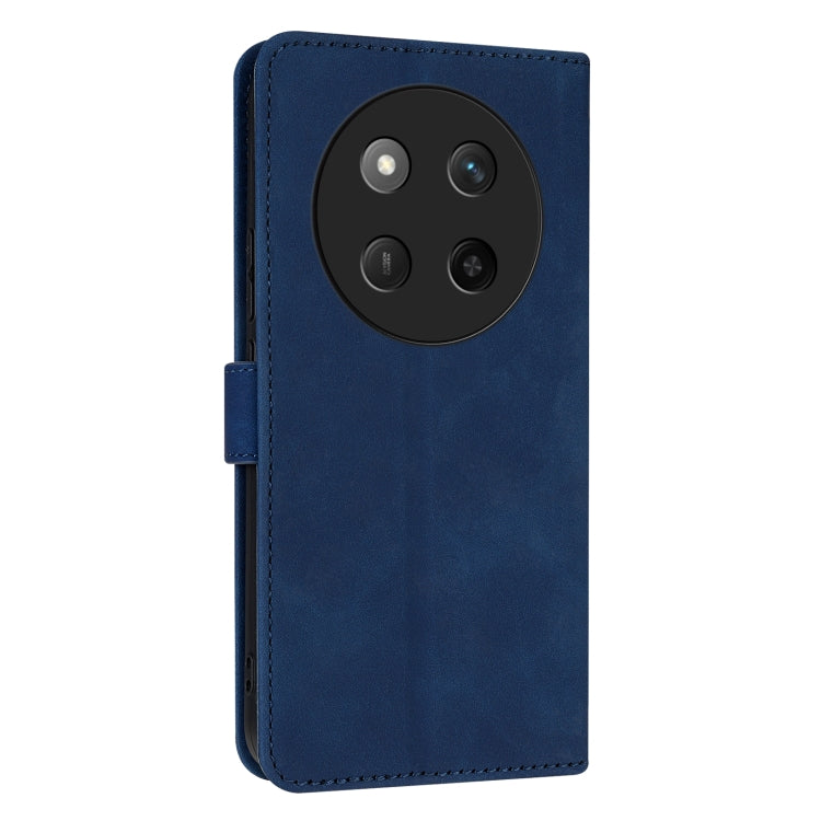 For Honor X60 Pro AZNS Skin Feel Calf Texture Flip Leather Phone Case