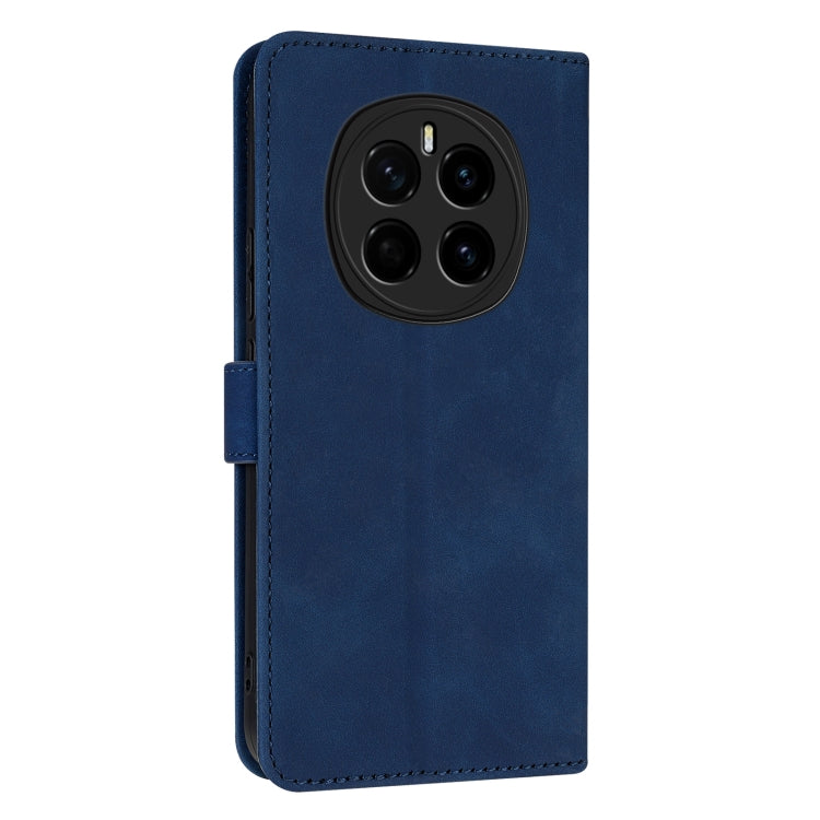For Honor Magic7 AZNS Skin Feel Calf Texture Flip Leather Phone Case