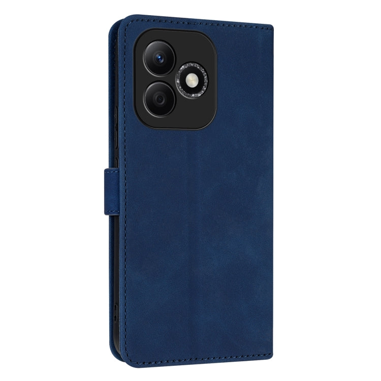 For Honor X60i AZNS Skin Feel Calf Texture Flip Leather Phone Case