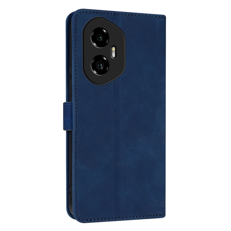 For Honor 300 AZNS Skin Feel Calf Texture Flip Leather Phone Case
