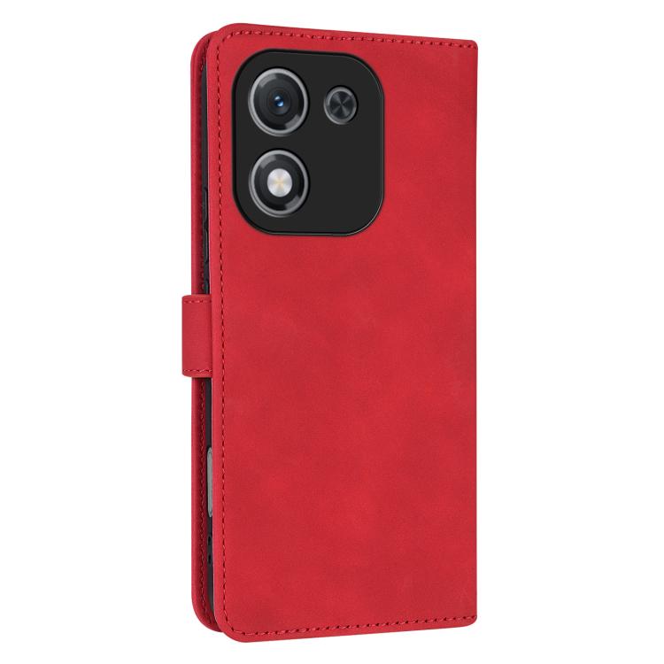 For Honor X70i AZNS Skin Feel Calf Texture Flip Leather Phone Case