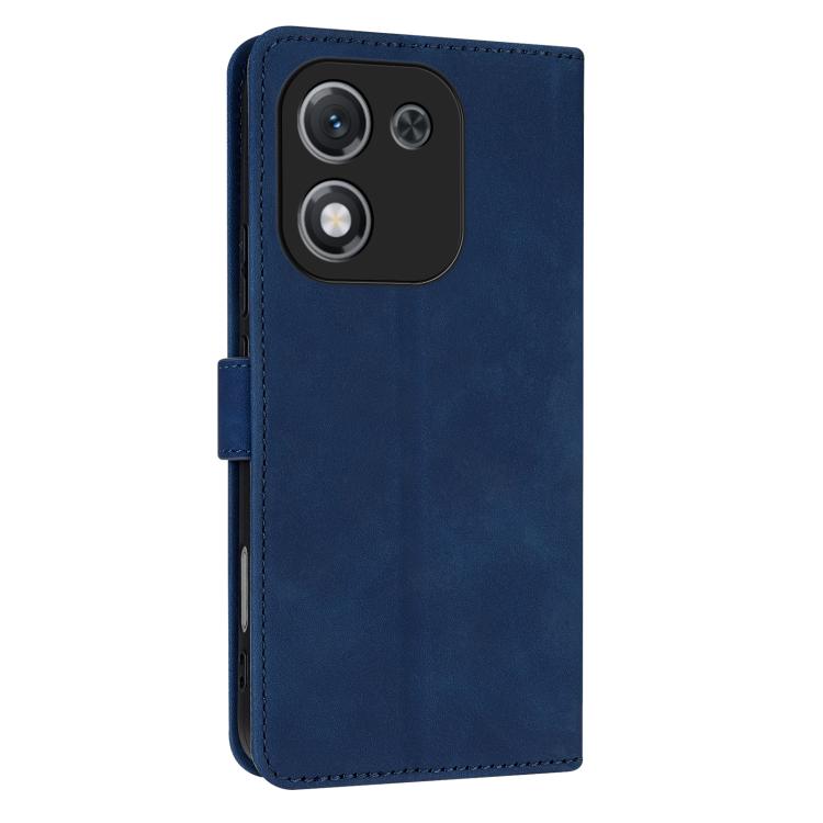 For Honor X70i AZNS Skin Feel Calf Texture Flip Leather Phone Case