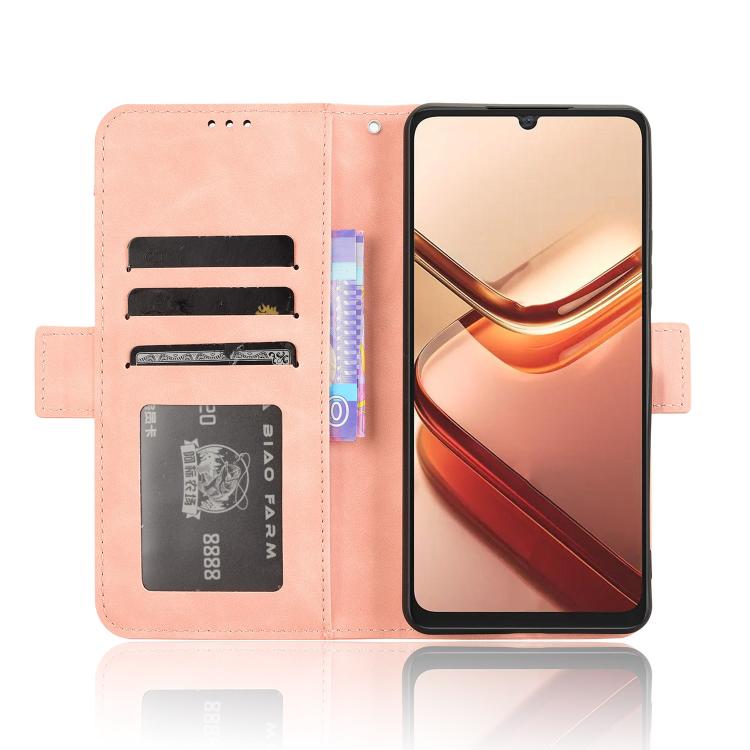 For Doogee Note 58 / Note 58 Pro Skin Feel Calf Texture Card Slots Leather Phone Case
