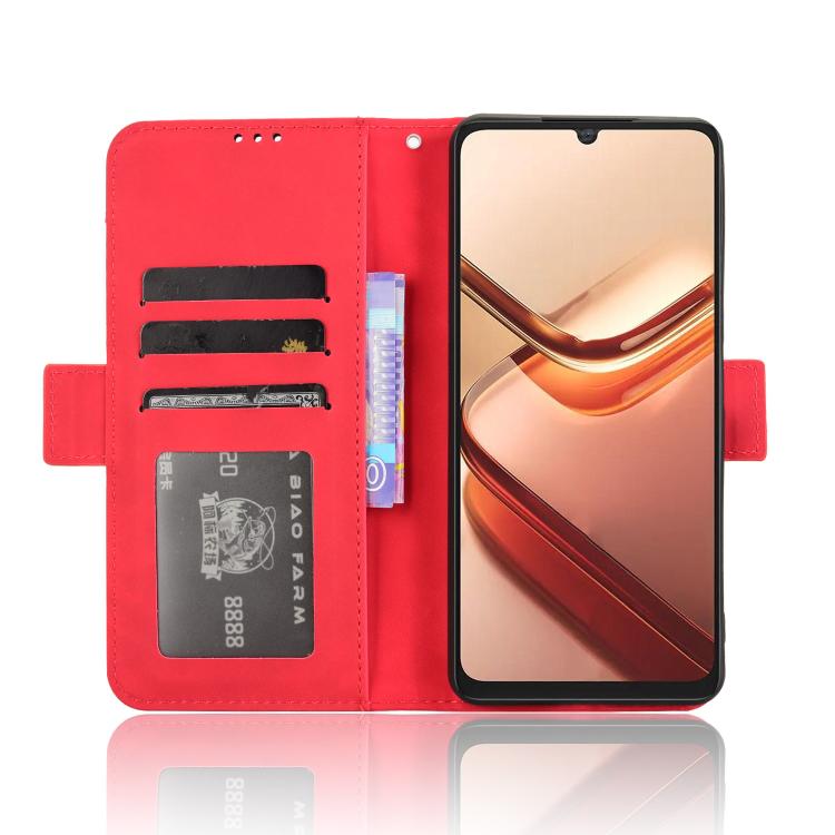 For Doogee Note 58 / Note 58 Pro Skin Feel Calf Texture Card Slots Leather Phone Case