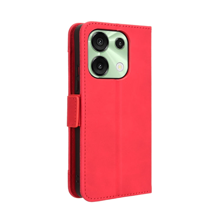 For Umidigi G9 5G / Note 90 Skin Feel Calf Texture Card Slots Leather Phone Case