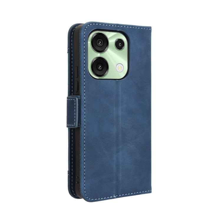 For Umidigi G9 5G / Note 90 Skin Feel Calf Texture Card Slots Leather Phone Case