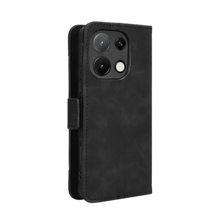 For Umidigi Note 100 / Note 100A Skin Feel Calf Texture Card Slots Leather Phone Case