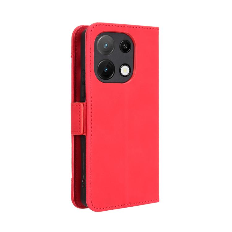 For Umidigi Note 100 / Note 100A Skin Feel Calf Texture Card Slots Leather Phone Case