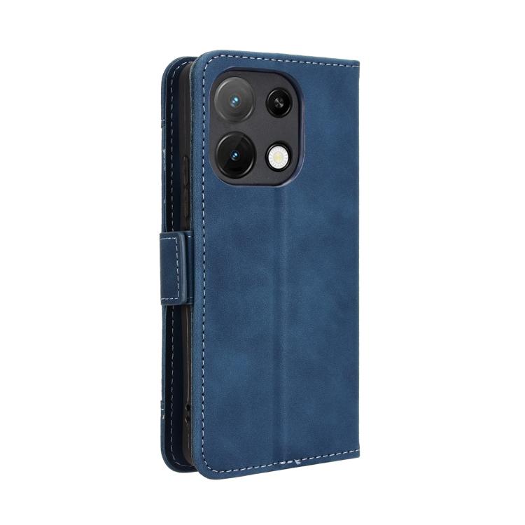 For Umidigi Note 100 / Note 100A Skin Feel Calf Texture Card Slots Leather Phone Case