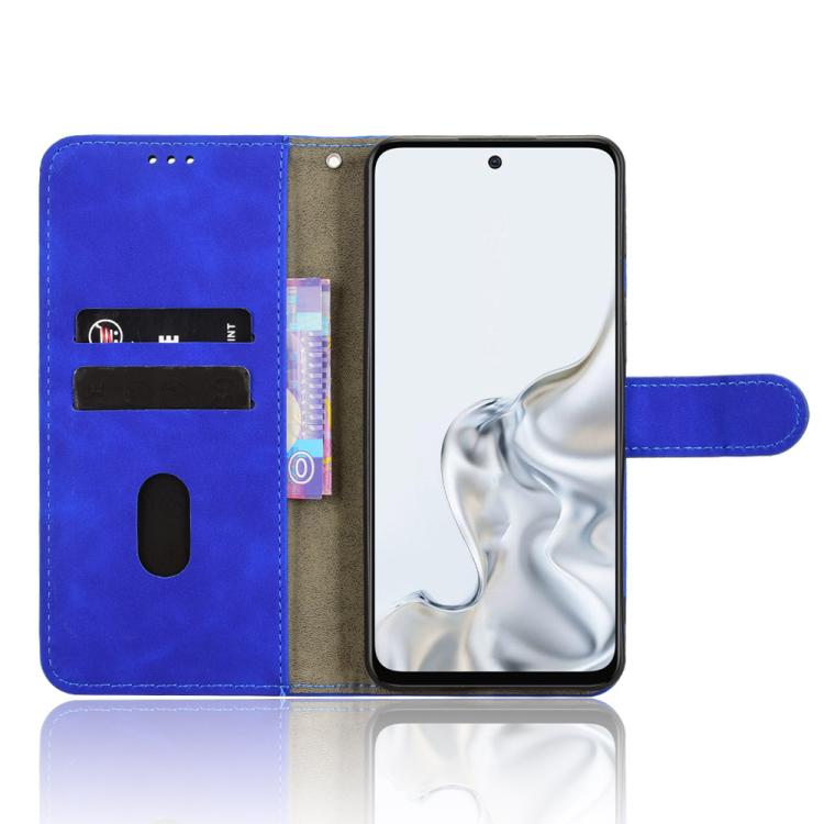 For ZTE nubia S2e / S2R / S2 Lite Skin Feel Magnetic Flip Leather Phone Case