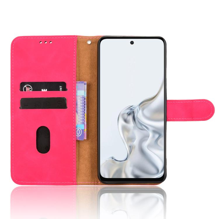 For ZTE nubia S2e / S2R / S2 Lite Skin Feel Magnetic Flip Leather Phone Case