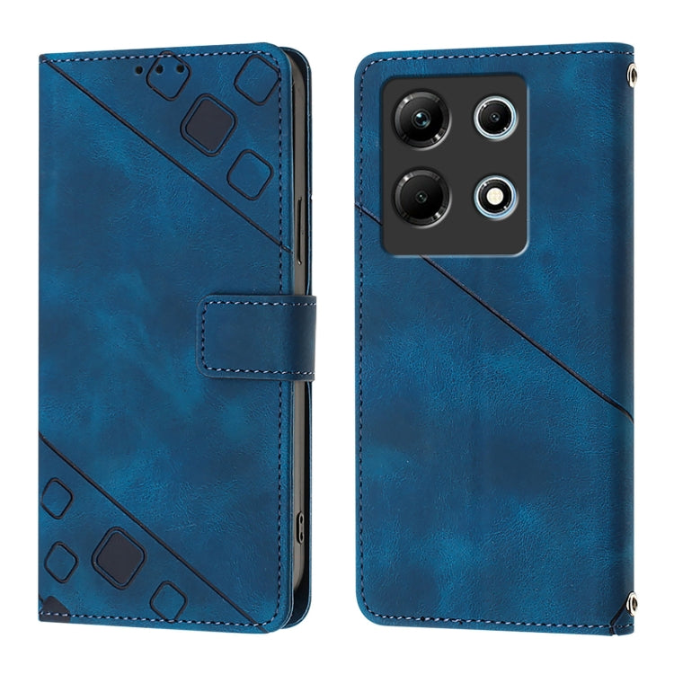 For Infinix Note 30 4G X6833B Skin Feel Embossed Leather Phone Case