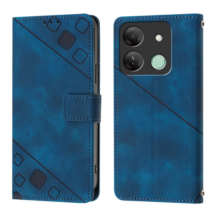 For Infinix Smart 7 India / 7 HD / 7 Plus Skin Feel Embossed Leather Phone Case