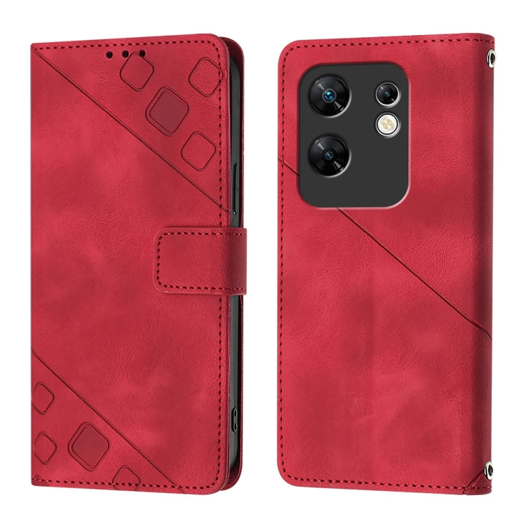 For Infinix Zero 30 4G Skin Feel Embossed Leather Phone Case