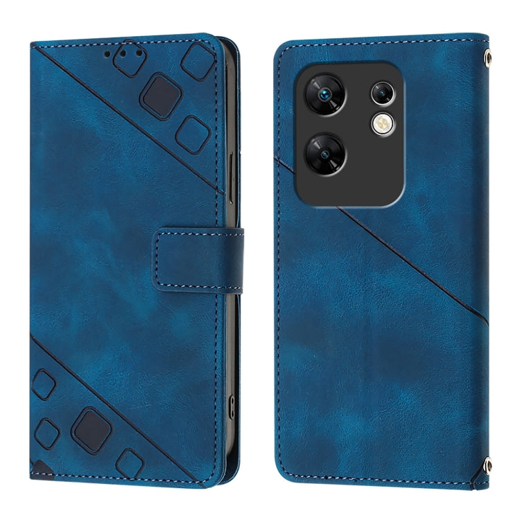 For Infinix Zero 30 4G Skin Feel Embossed Leather Phone Case