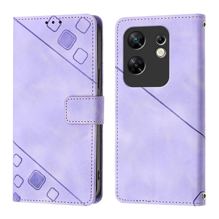 For Infinix Zero 30 4G Skin Feel Embossed Leather Phone Case