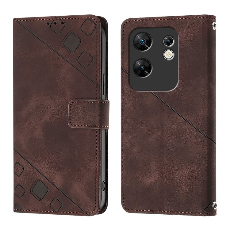 For Infinix Zero 30 4G Skin Feel Embossed Leather Phone Case