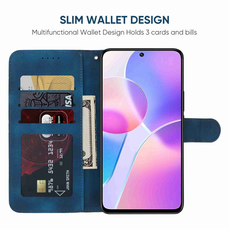 For Honor X30i Skin Feel Geometric Lines Leather Phone Case