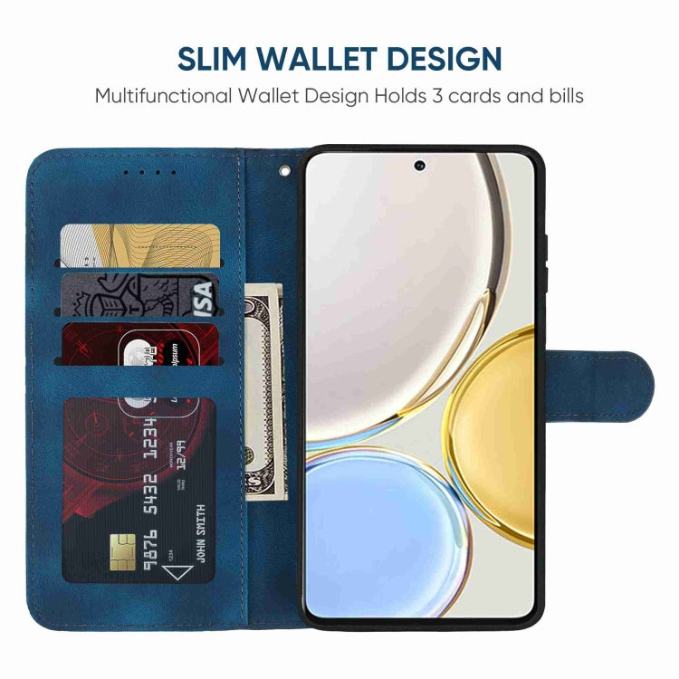 For Honor X9 Skin Feel Geometric Lines Leather Phone Case