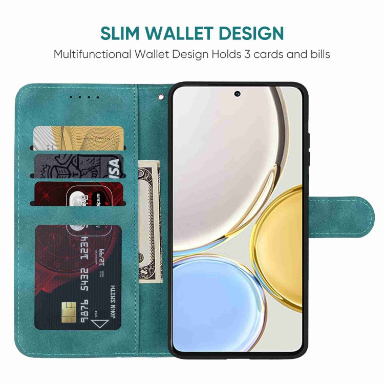 For Honor X9 Skin Feel Geometric Lines Leather Phone Case