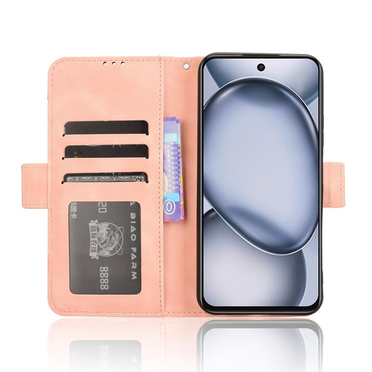 For itel A80 4G Skin Feel Calf Texture Card Slots Leather Phone Case