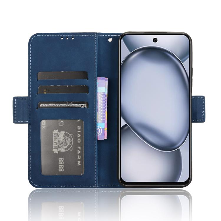 For itel A80 4G Skin Feel Calf Texture Card Slots Leather Phone Case