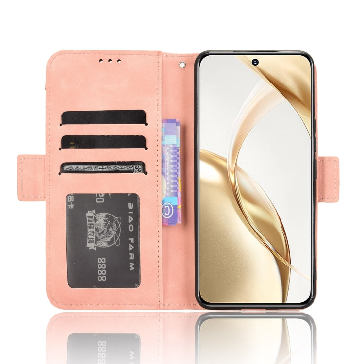 For Honor 200 5G Skin Feel Calf Texture Card Slots Leather Phone Case