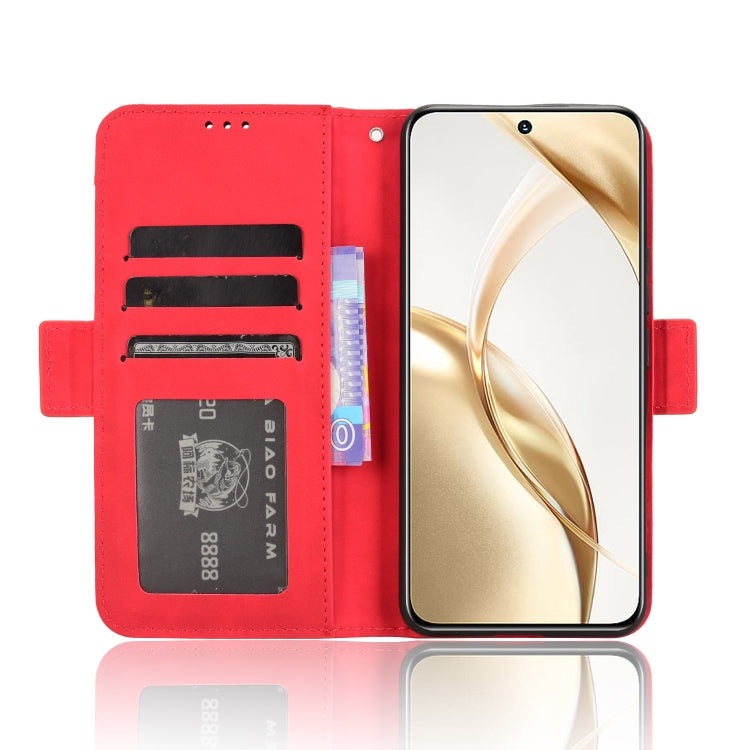 For Honor 200 5G Skin Feel Calf Texture Card Slots Leather Phone Case