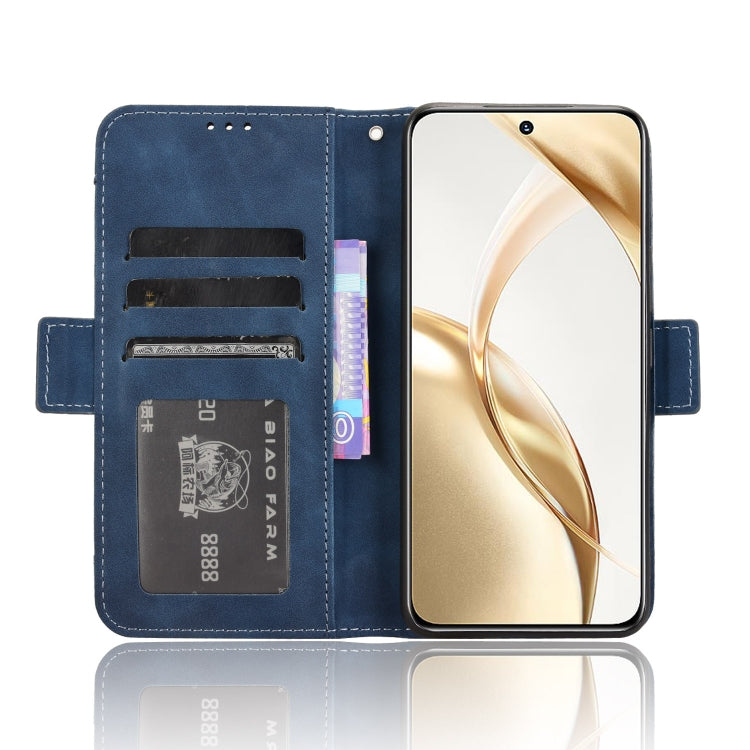 For Honor 200 5G Skin Feel Calf Texture Card Slots Leather Phone Case