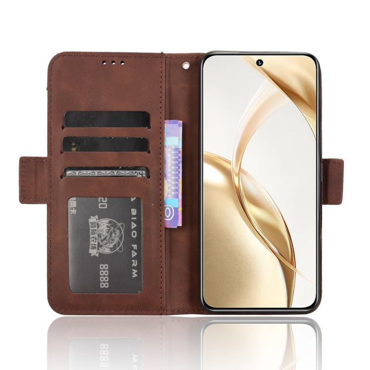 For Honor 200 5G Skin Feel Calf Texture Card Slots Leather Phone Case