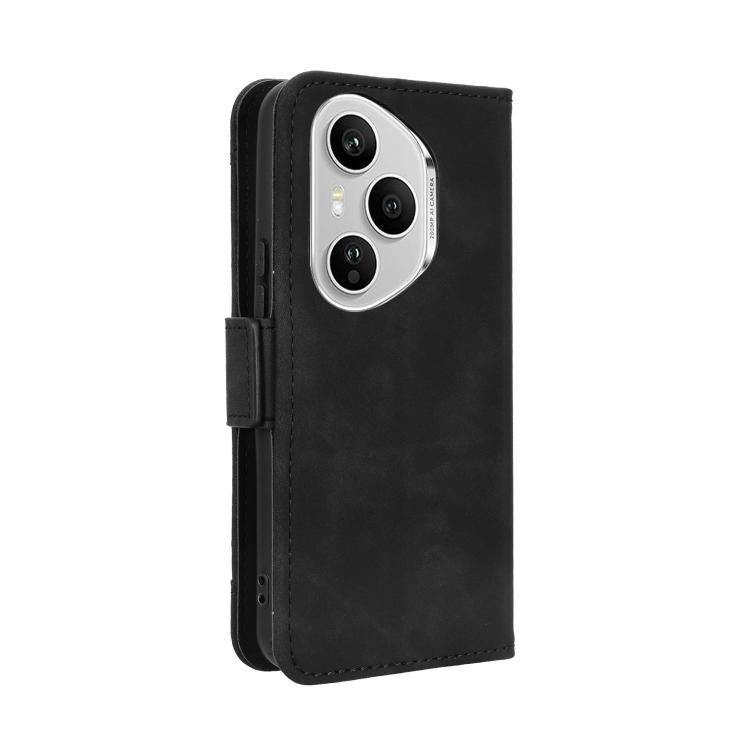 For Honor 400 Pro Global 160.8mm Skin Feel Calf Texture Card Slots Leather Phone Case