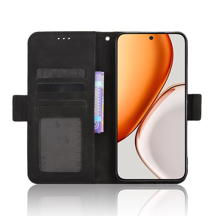 For Honor X70 5G / X9d 5G Skin Feel Calf Texture Card Slots Leather Phone Case