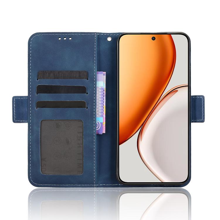 For Honor X70 5G / X9d 5G Skin Feel Calf Texture Card Slots Leather Phone Case