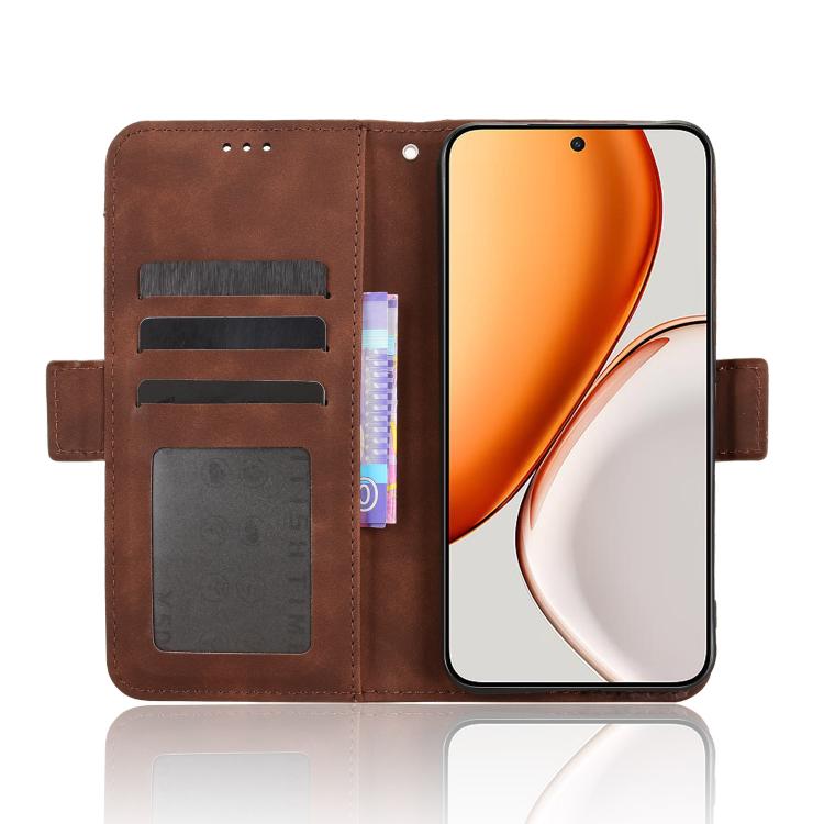 For Honor X70 5G / X9d 5G Skin Feel Calf Texture Card Slots Leather Phone Case