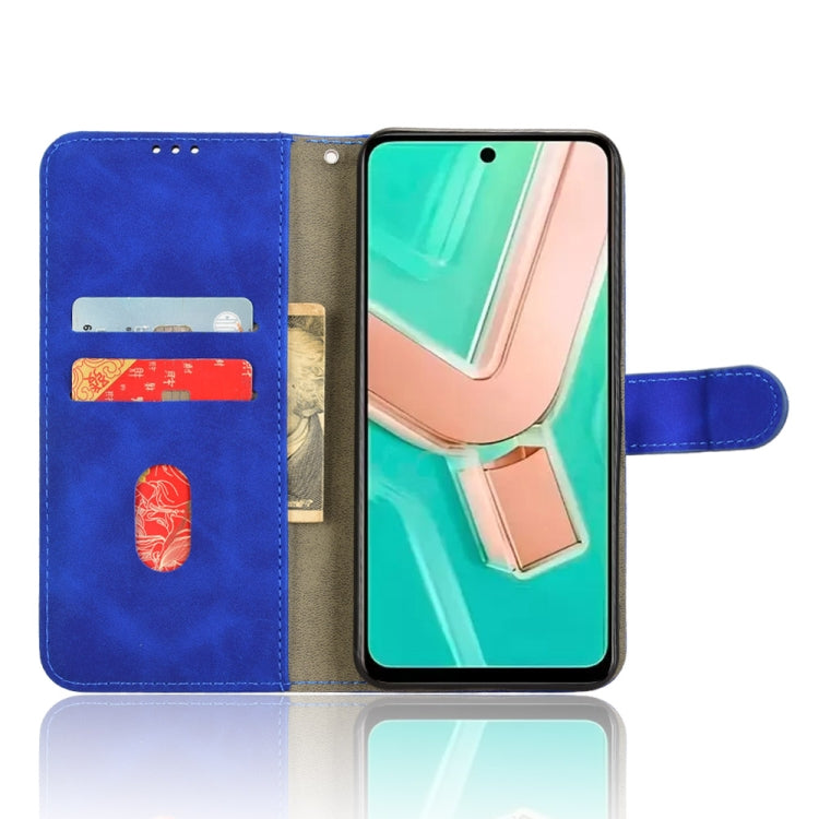 For vivo Y28 4G Skin Feel Magnetic Flip Leather Phone Case