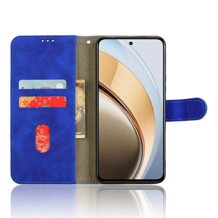 For vivo V40 Lite 5G Skin Feel Magnetic Flip Leather Phone Case