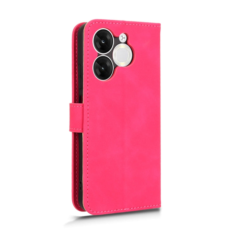 For itel A80 Skin Feel Magnetic Flip Leather Phone Case