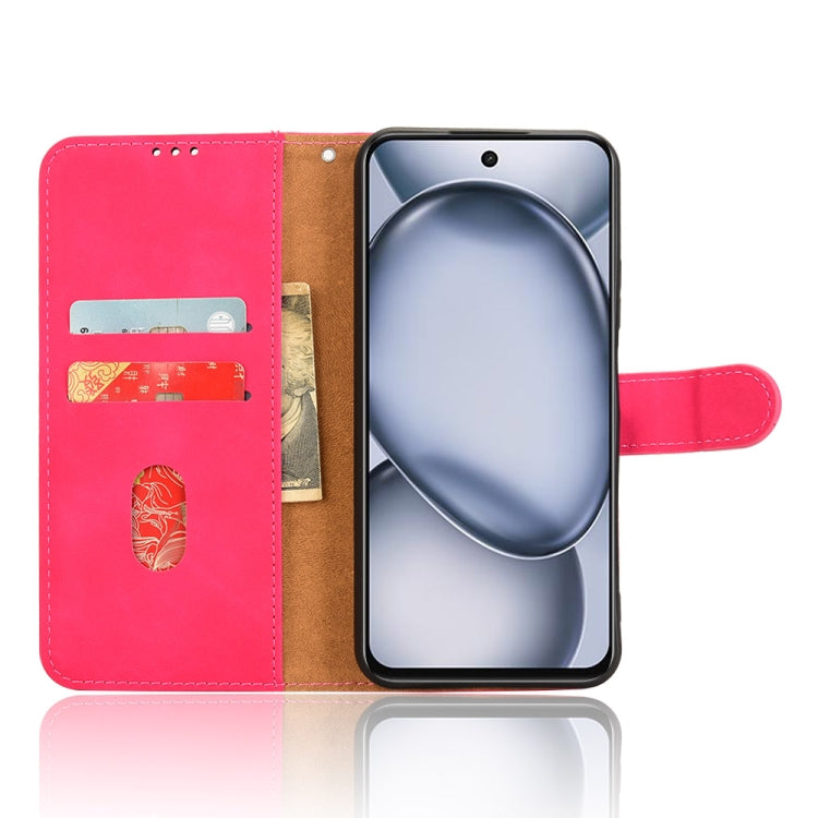 For itel A80 Skin Feel Magnetic Flip Leather Phone Case