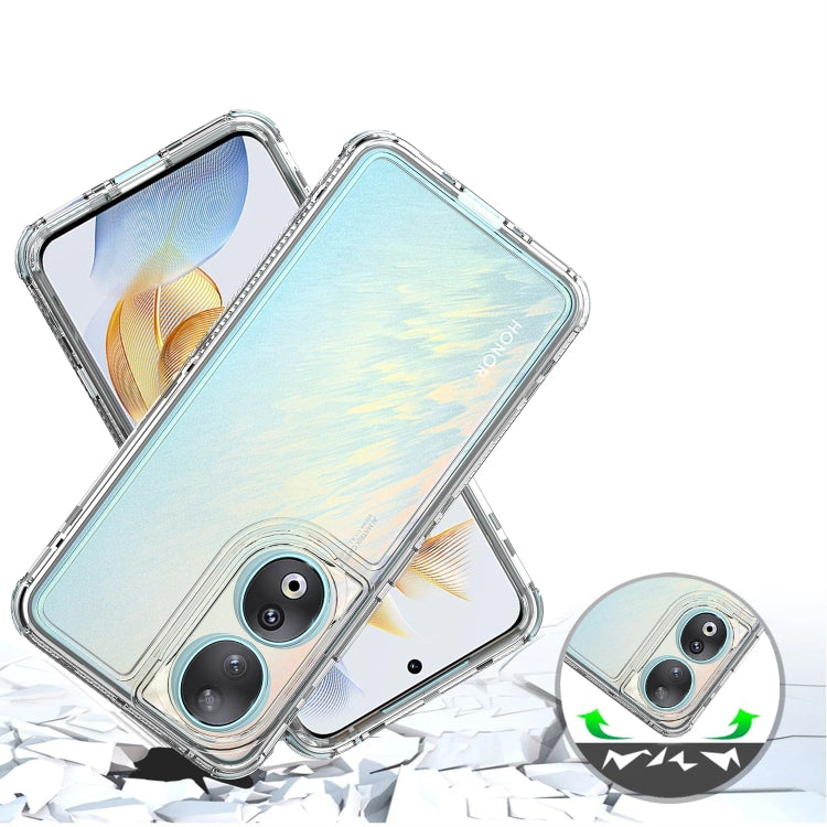 For Honor 90 Acrylic Transparent Phone Case