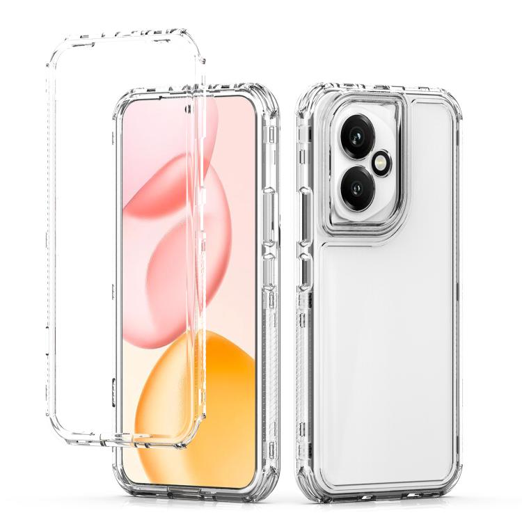For Honor 400 Global 156.5mm Acrylic Transparent Phone Case