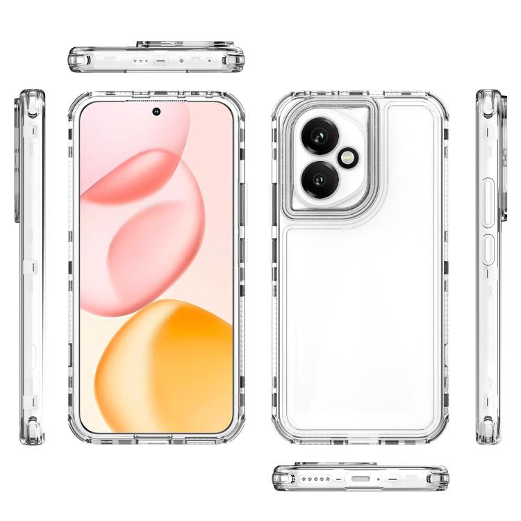 For Honor 400 Global 156.5mm Acrylic Transparent Phone Case