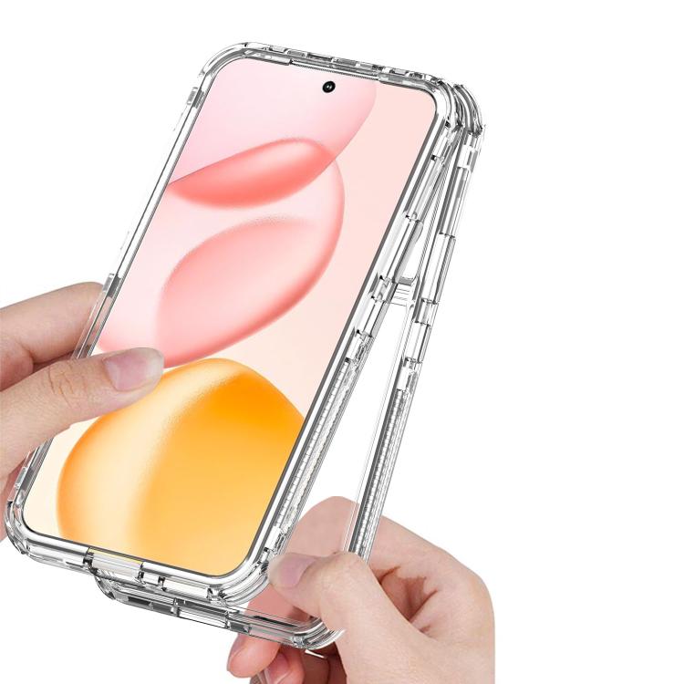 For Honor 400 Global 156.5mm Acrylic Transparent Phone Case